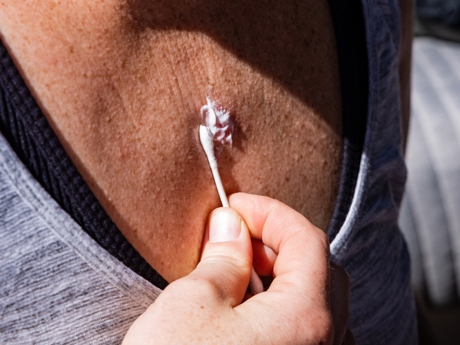Mahalliy immunomodulyatorlar